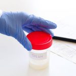 Scandale du sperme contaminé : une mutation génétique provoque une vague de cancers